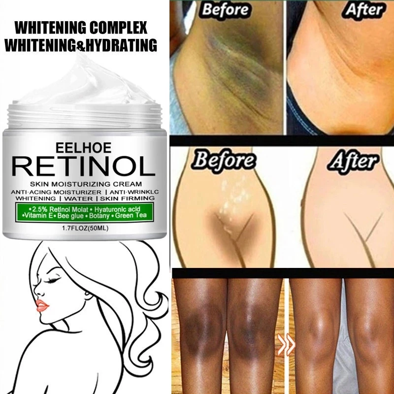 Luxury Lifestyle Products - Body Whitening Cream Private Parts Underarm